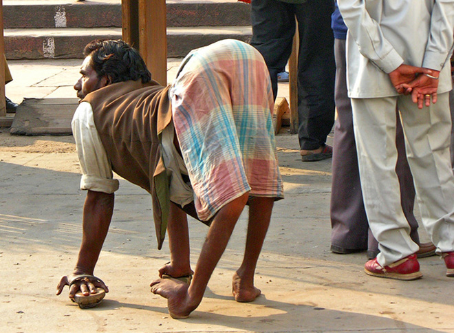 L’OMS retire le Nigeria de la liste des pays où la polio est endémique