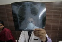 Tuberculose multirésistante: un nouveau traitement efficace dans 90% des cas (étude)