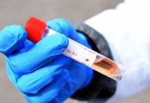 Coronavirus: Les Etats-Unis ont commencé à effectuer des tests d’immunité