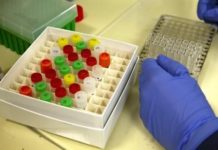 Covid-19: une équipe suisso-américaine découvre un anticorps humain jugé « prometteur »